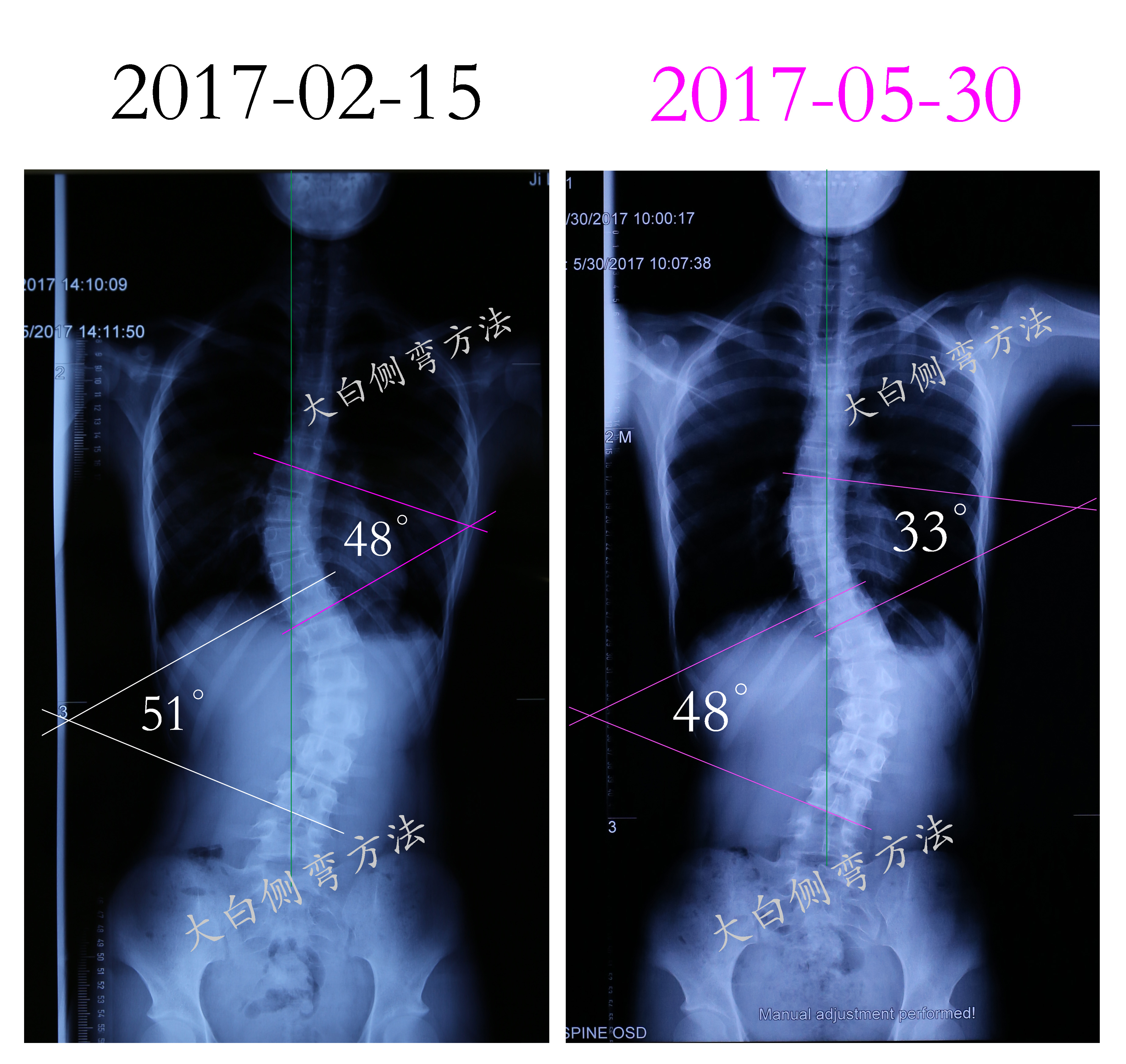 孩子的