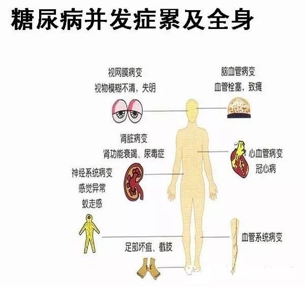 糖尿病性心肌病