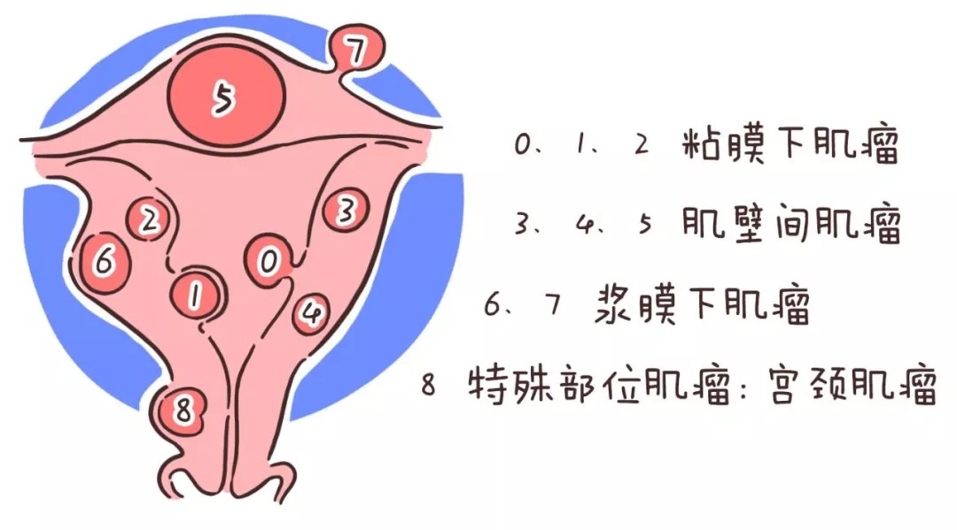 常见妇科病自疗全图解蜂